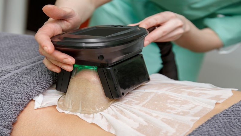 Cryolipolysis