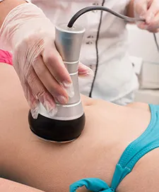 Laser Treatment